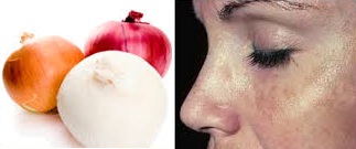 cebolla aclarar manchas encontramos alimentos comunes