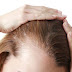 5 Tips to Help Prevent Hair Loss