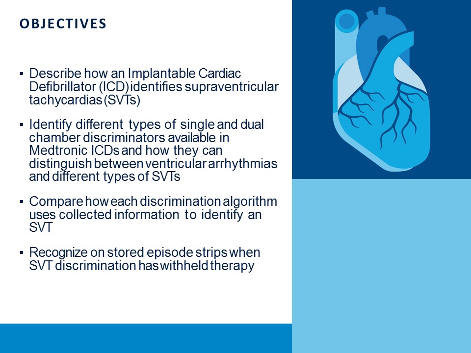 CVT Mohd Farid: Concept Of ICD Technology-SVT Discrimination Algorithms ...