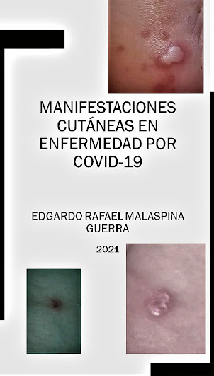 MANIFESTACIONES CUTÁNEAS EN ENFERMEDAD POR COVID-19