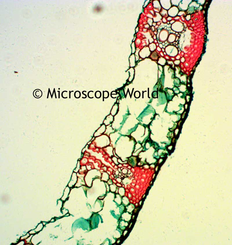 Wheat Leaf Rust at 100x magnification under the microscope.