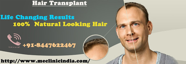 Hair Transplant Surgeons in Delhi