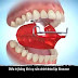 Phương pháp nâng khớp cắn trong niềng răng là gì?