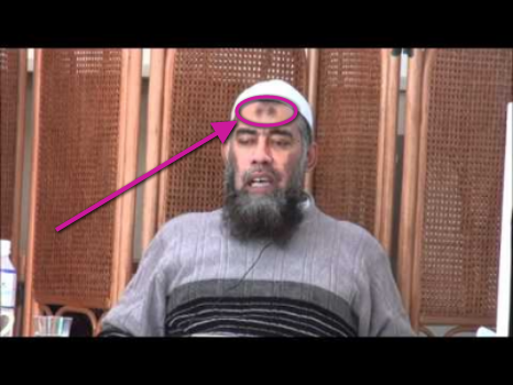 Hati-Hati Dengan Tanda Hitam Di Jidat Lantaran Shalat,, Lantaran Itu Adalah... Hati-Hati Dengan Tanda Hitam Di Jidat Lantaran Shalat,, Lantaran Itu Adalah...