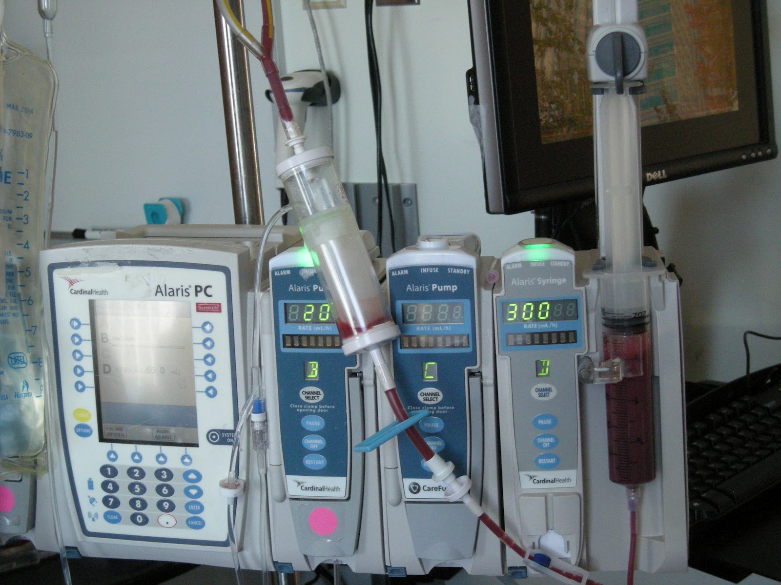 Daniels Northwestern Transplant: Reinfusion-Transplant Day- Monday