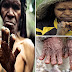 بالصور.. قبيلة في أندونسيا تقطع الأصابع حزنا على الميت!