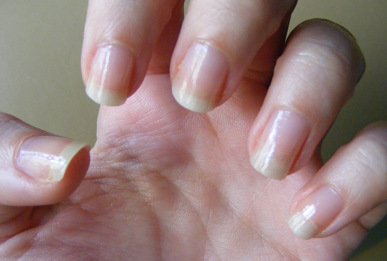 Normal Color of Nail Bed - wide 7