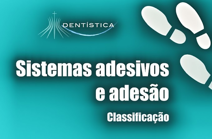 ADESIVOS DENTAIS: Sistemas Adesivos e Adesão. Classificação - Videoconferência de Gustavo Rivera