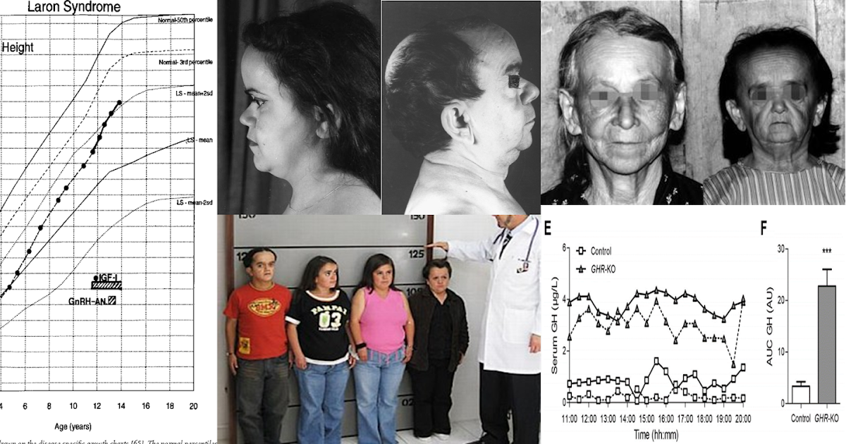 Sarango Cuenca Paulo David P6: Cuadro clínico (síntomas y signos) del