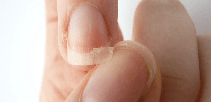 remedio para fortalecer las uñas