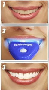 White Light Dental Teeth care
