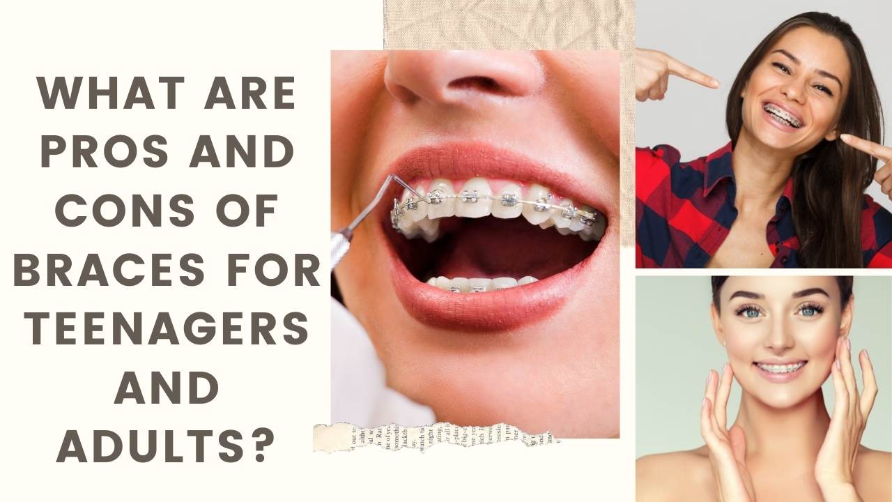What Are Pros And Cons Of Braces For Teenagers And Adults?