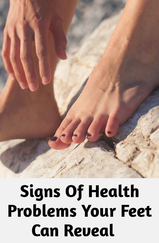 10 Health Problems That Feet Changes Can Reveal Health Fitness Detox