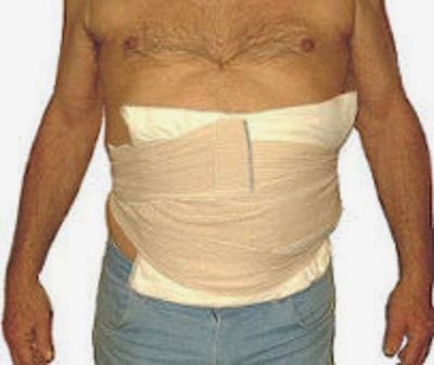 Abd bandage Clearance