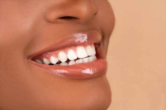 Home Remedies, Teeth Whitening, Teeth, Oral Health, Oral Hygiene, Teeth, Health