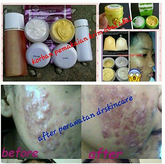 Cerita Dalam Hening SKIN CARE YANG PALING BAGUS dan AMAN