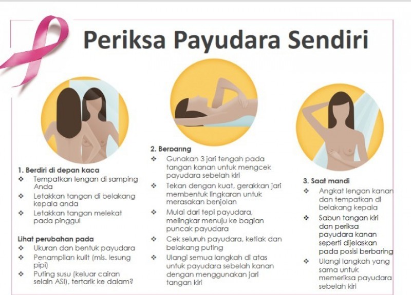 Deteksi Kanker Payudara Sedini Mungkin SADARI - Ina Tanaya