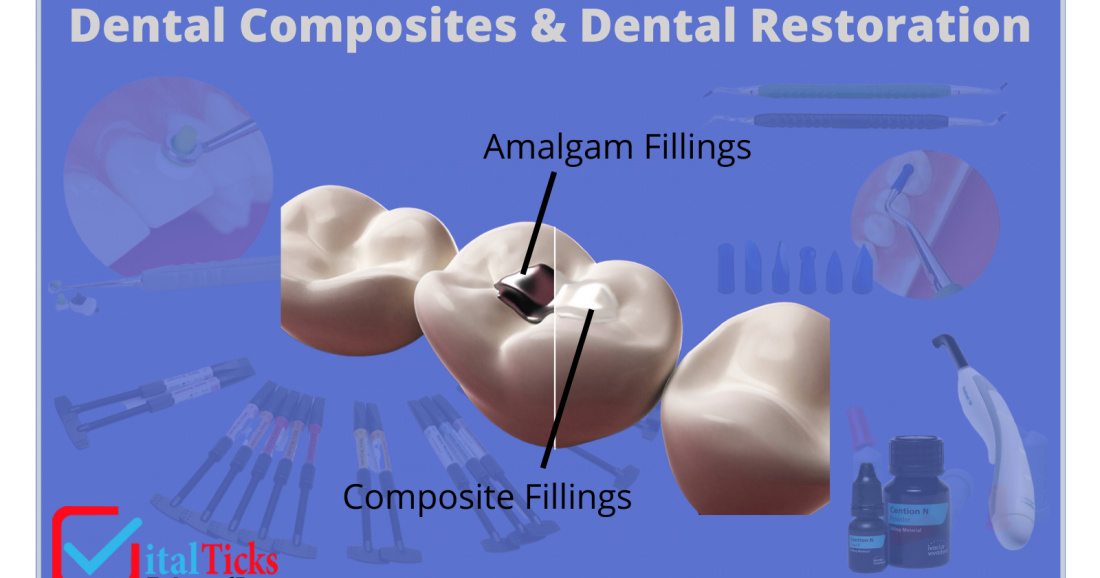 Can you think of Dental Restoration without composites?
