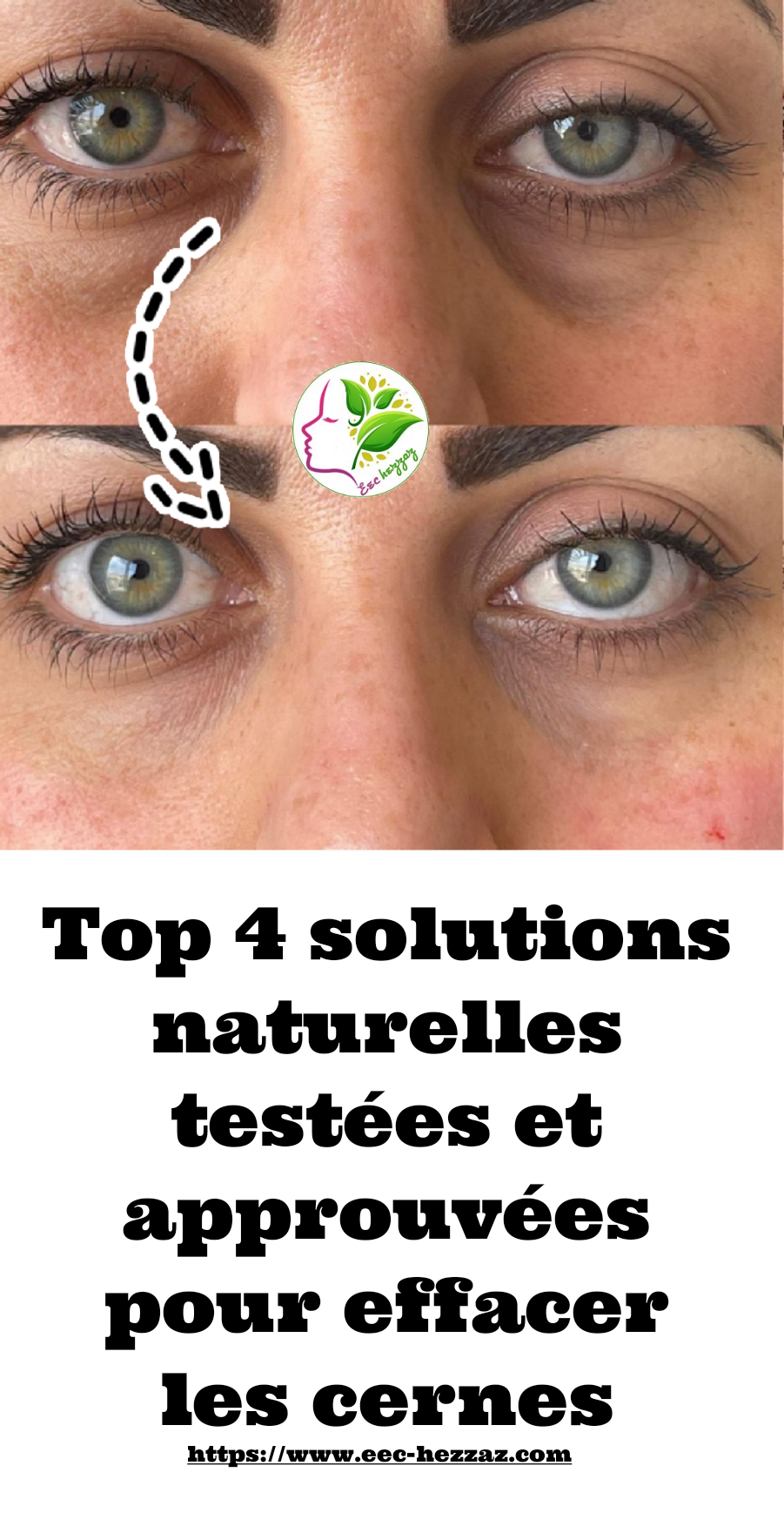 Top 4 solutions naturelles testées et approuvées pour effacer les cernes