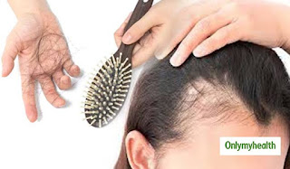 How Control Hair Fall And Hair Dandruff Naturally
