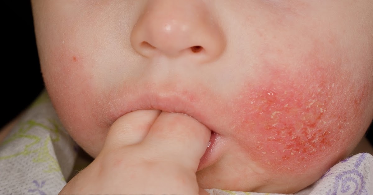 Study Medical Photos An 18monthold Boy Comes to Clinic With a