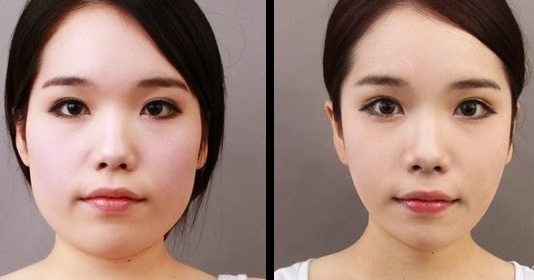 Cara Meniruskan Pipi Tembem Secara Alami dan Cepat