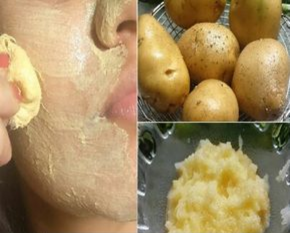 Masque de pomme de terre pour la peau grasse