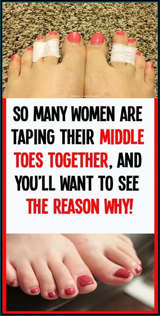 So Many Women Are Taping Their Middle Toes Together, And You’ll Want To