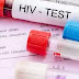 Category of People who can never get HIV, are you among them? Find out