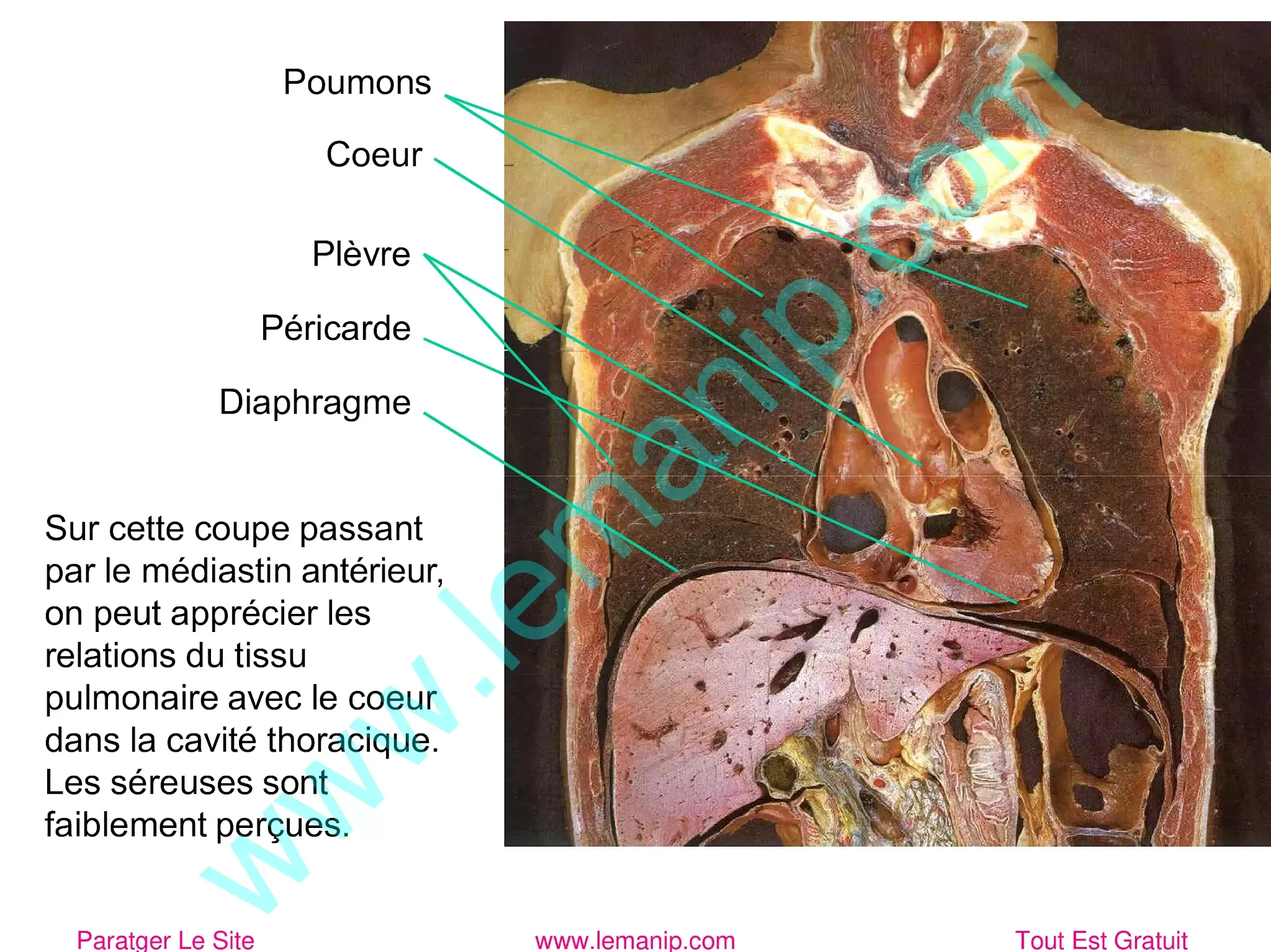 coupe passant par le médiastin antérieur