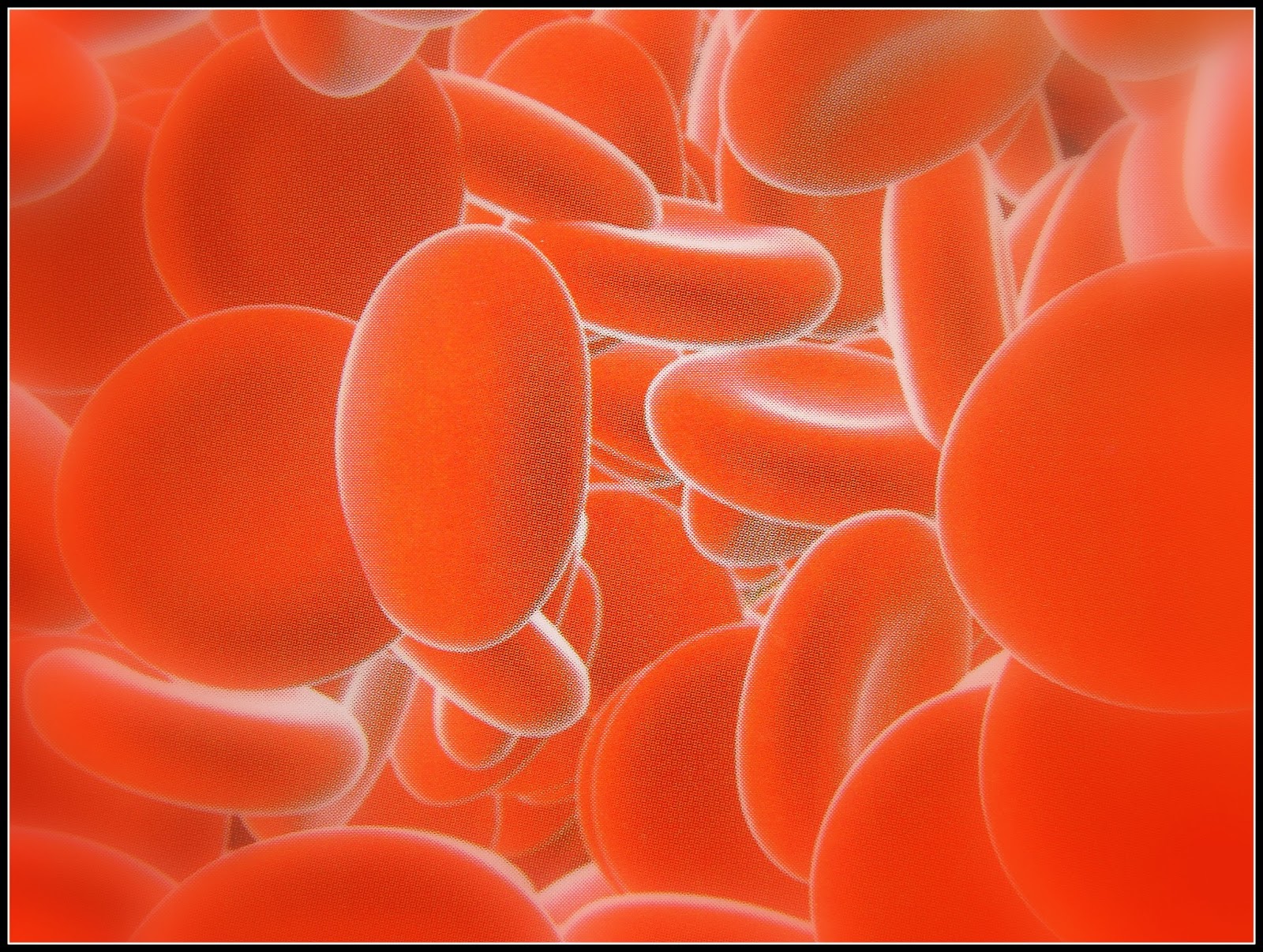 Niedokrwistość z niedoboru żelaza