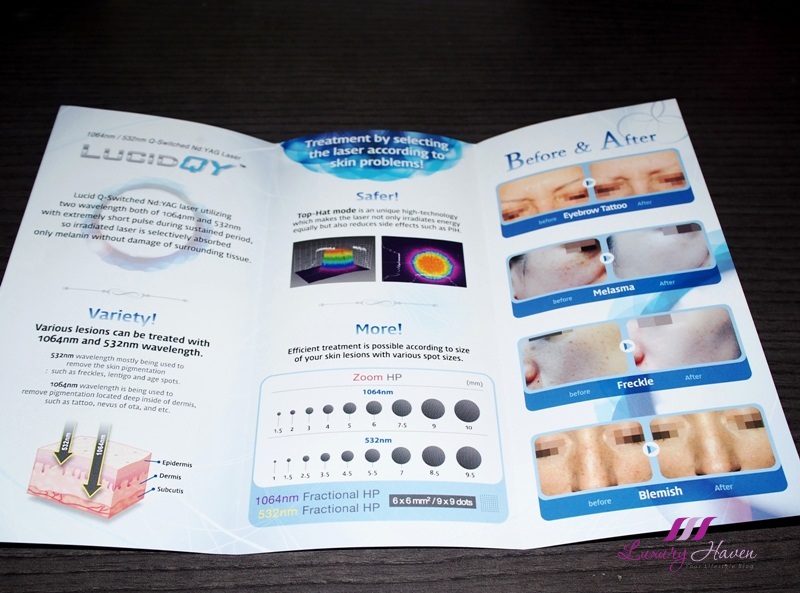 Anlagen Hafen Tugend nd yag laser review Direkt Trainer Wirtschaftlich