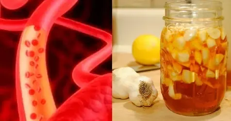is garlic good for reducing cholesterol is garlic good for reducing cholesterol