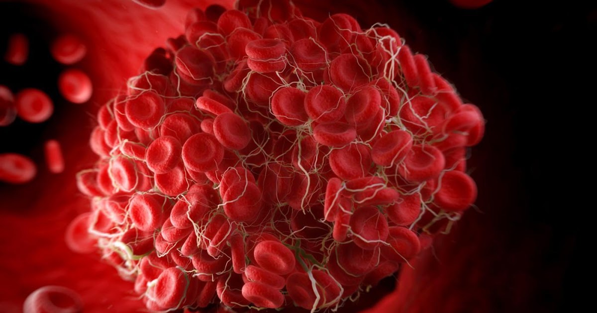 5, which shows that you have a blood clot in the body Health care