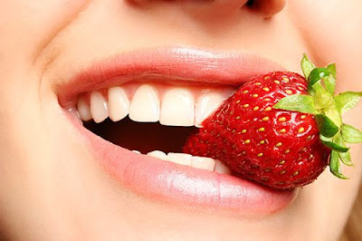 Bọc răng sứ cercon có bền không?
