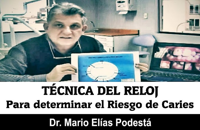 RIESGO DE CARIES: Técnica del Reloj - Dr. Mario Elías Podestá