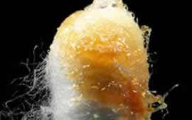 Best Drops for Earwax Removal | Fauquier ENT Blog