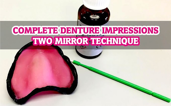 COMPLETE DENTURE Impressions - Two Mirror Technique