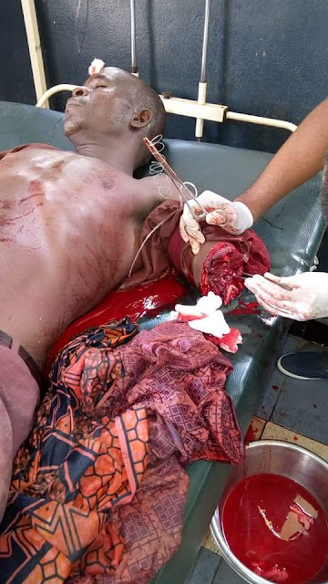 Graphic photos: Man dies in Anambra after his brother chopped off his hand over land dispute