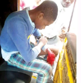 IED Explodes In Secondary School, Chops Student's Hand Off