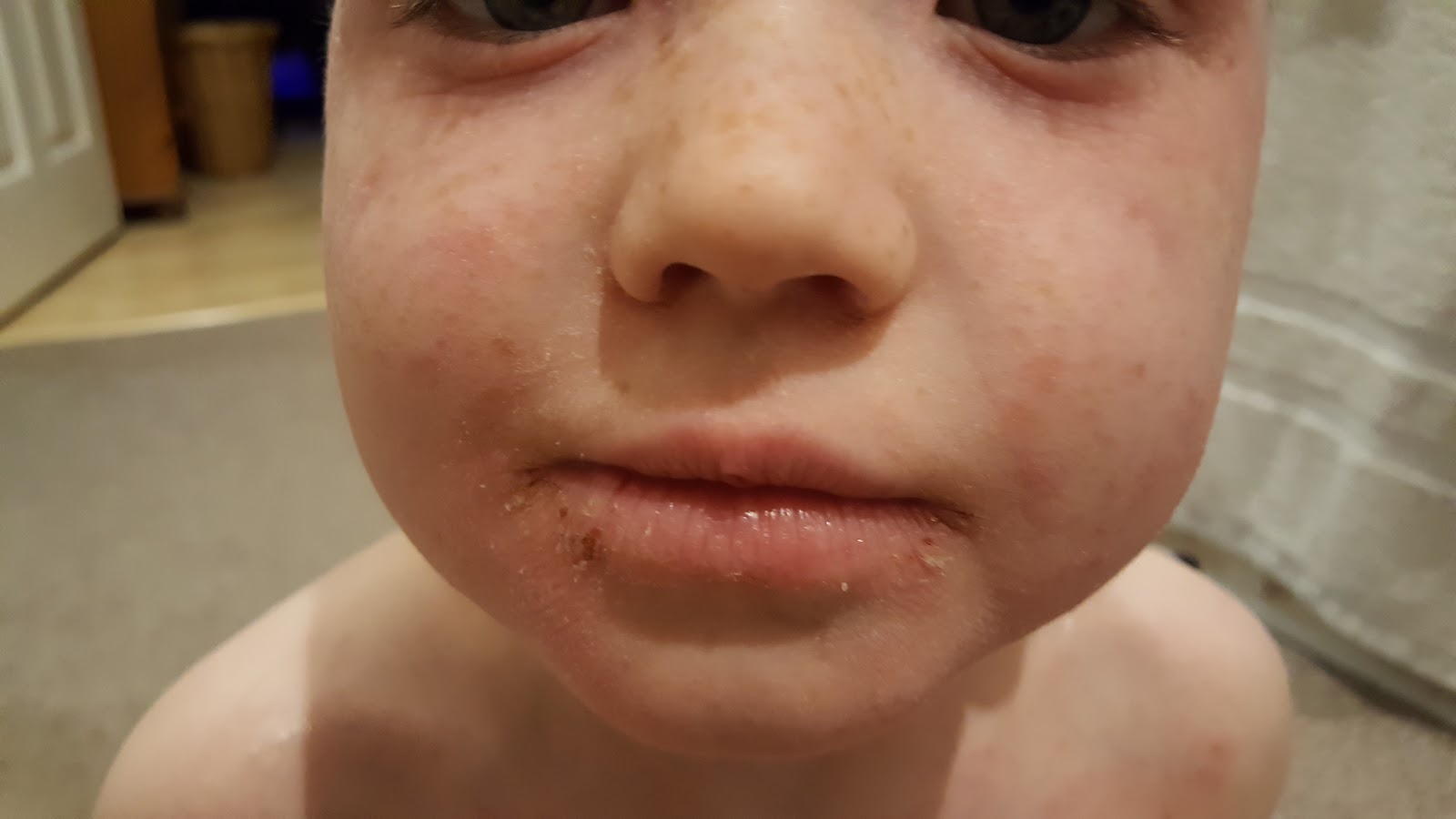 Life in my houseful of boys Eczema Jammies