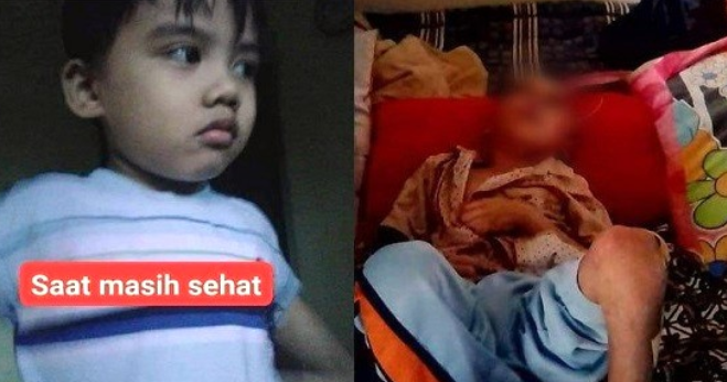 Viral Bocah 7 Tahun Di Bandung Diduga Dianiaya Orangtua Kandung Hingga