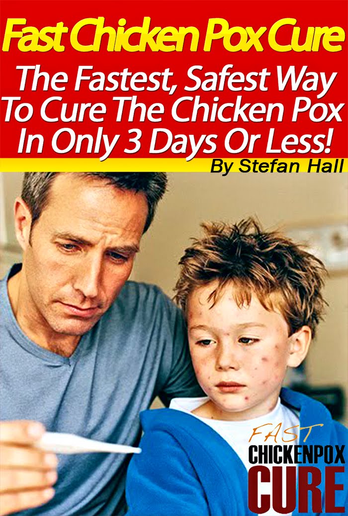 Fast Chicken Pox Cure Video Program