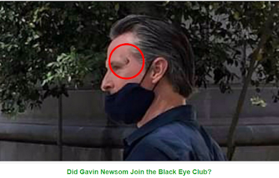 Ghislaine Maxwell Now In The "Black Eye Club" -- And a Review Of All