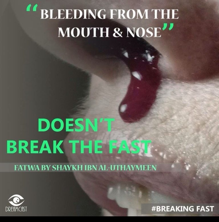 bleeding form the mouth and nose