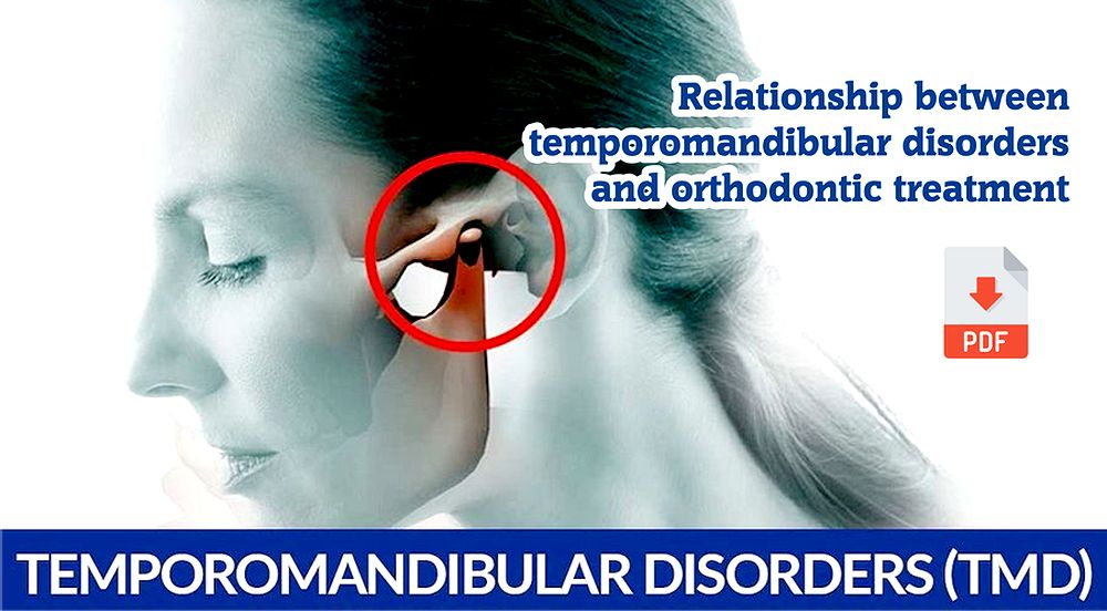 PDF Relationship between TemporoMandibular Disorders and Orthodontic