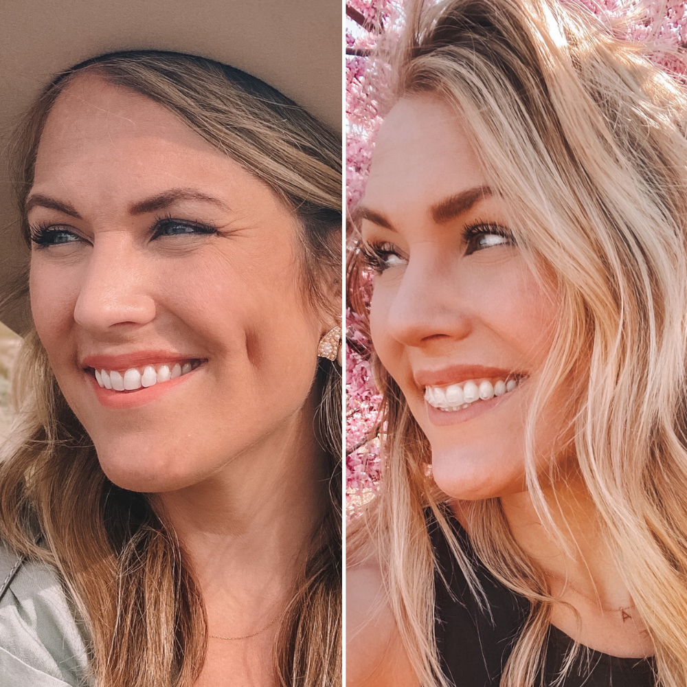 OKC based blogger Amanda's OK shares a before and after of clear aligner treatment with Lewis Orthodontics