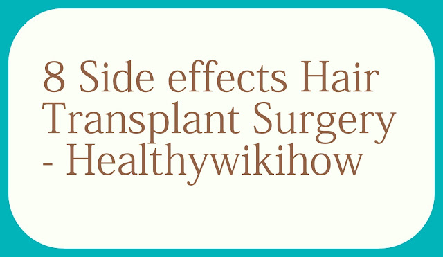 About 8 Side effects disadvantages Hair Transplant Surgery – Healthywikihow About 8 Side effects disadvantages Hair Transplant Surgery – Healthywikihow