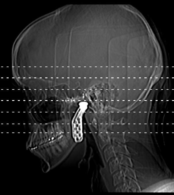 Blogged Up Body Blogged Up Life Radiology