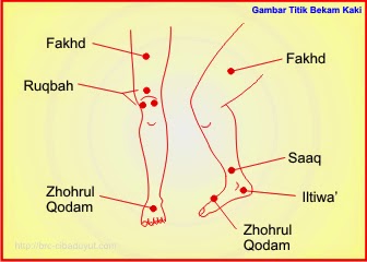 BEKAM TITIK SUNAH NABI - Klinik Bekam Thibbun Nabawi ABU AULIA